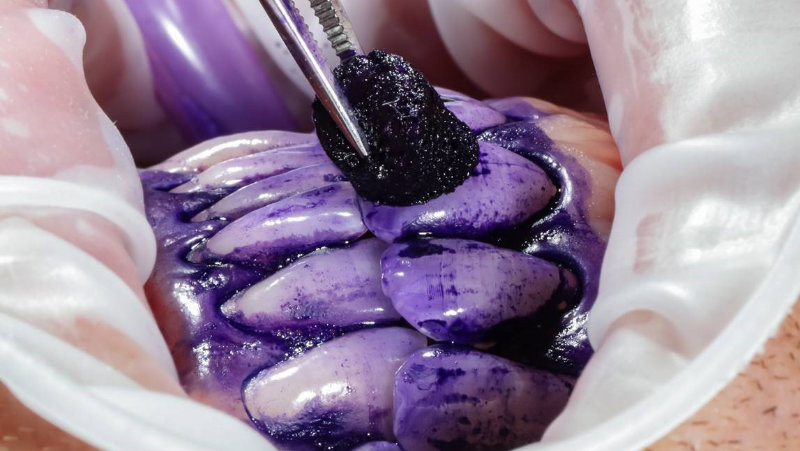 Biofilm Discloser John Hoggard