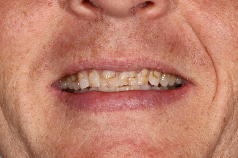 IMG 0761 1259