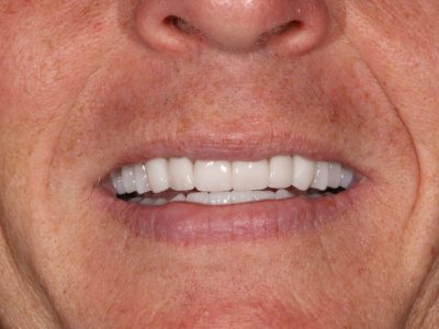Gallery 3 IMG 1647 1259
